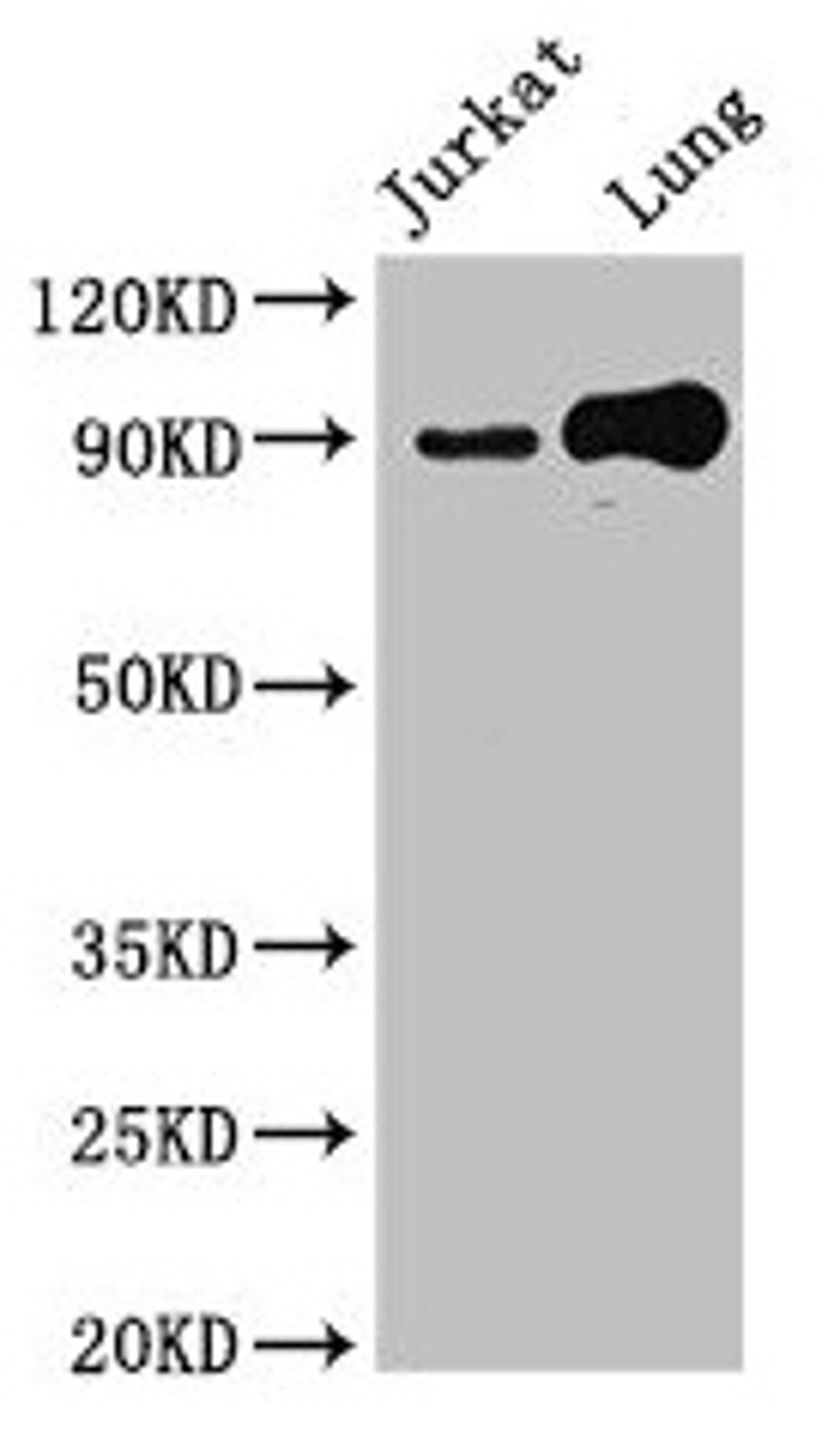 Western Blot. Positive WB detected in: Jurkat whole cell lysate, Mouse lung tissue. All lanes: STAT5B antibody at 2.4µg/ml. Secondary. Goat polyclonal to rabbit IgG at 1/50000 dilution. Predicted band size: 90 kDa. Observed band size: 90 kDa