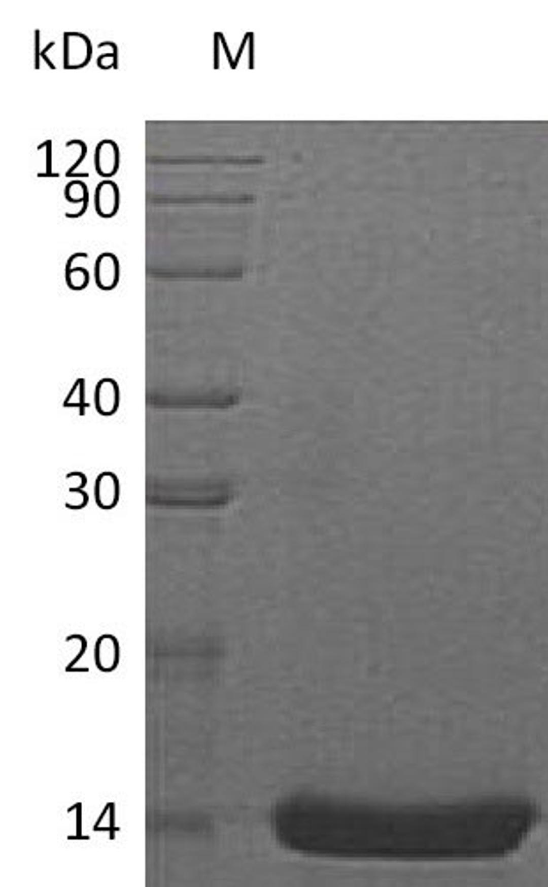 (Tris-Glycine gel) Discontinuous SDS-PAGE (reduced) with 5% enrichment gel and 15% separation gel.