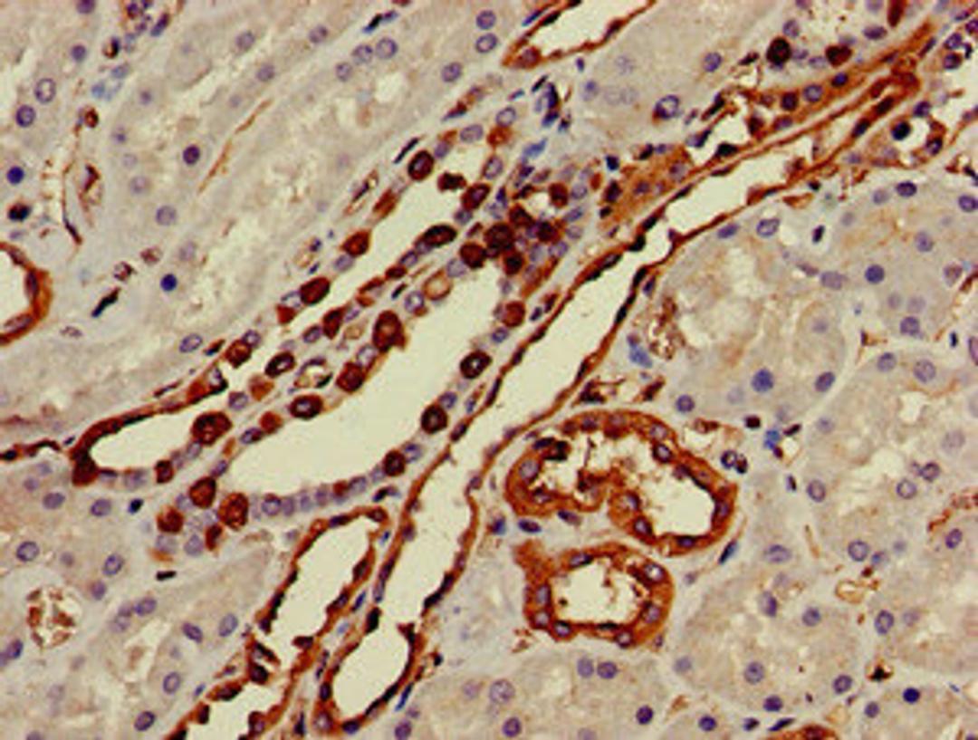 Immunohistochemistry of paraffin-embedded human kidney tissue using CSB-PA884421LA01HU at dilution of 1:100