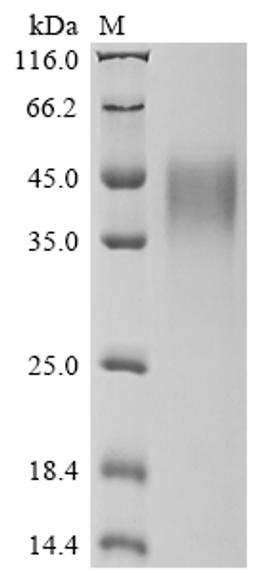 (Tris-Glycine gel) Discontinuous SDS-PAGE (reduced) with 5% enrichment gel and 15% separation gel.