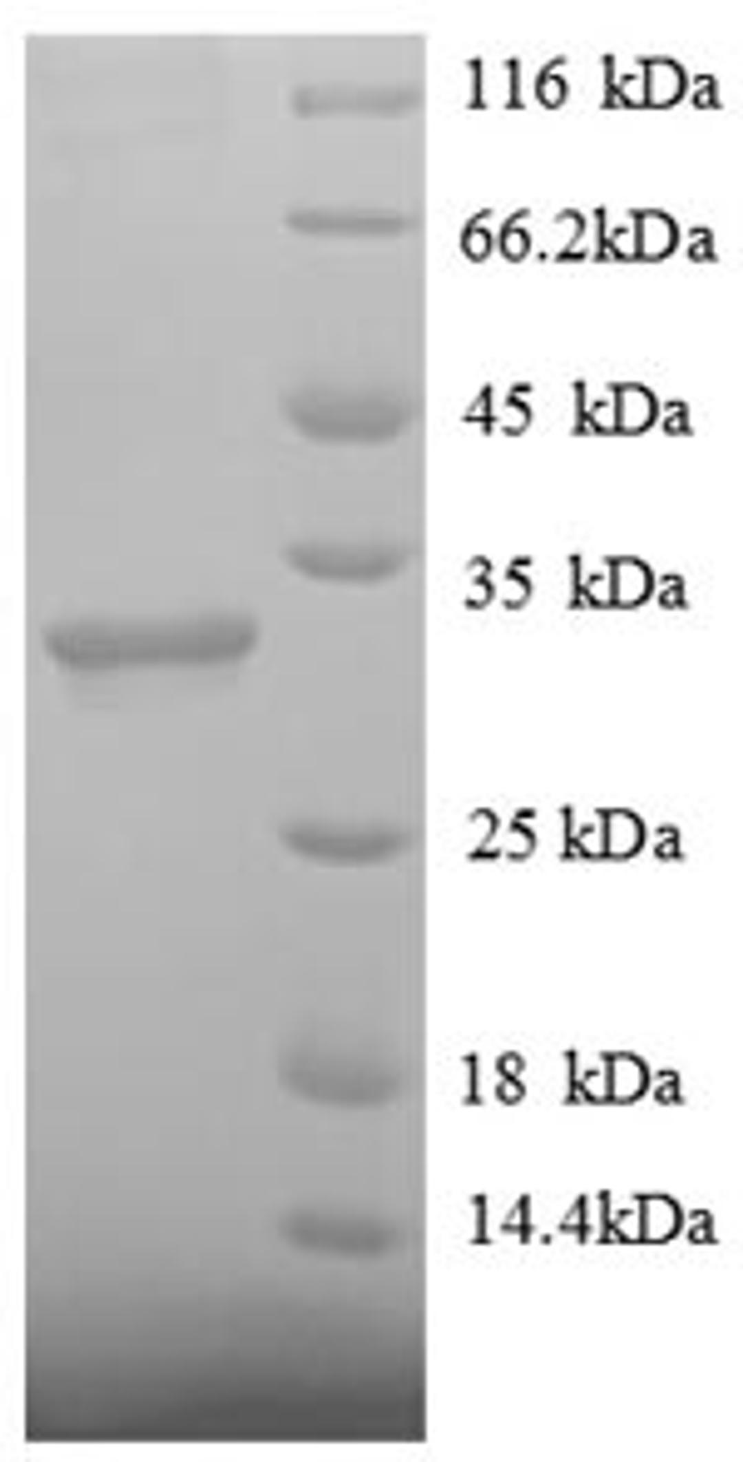 (Tris-Glycine gel) Discontinuous SDS-PAGE (reduced) with 5% enrichment gel and 15% separation gel.