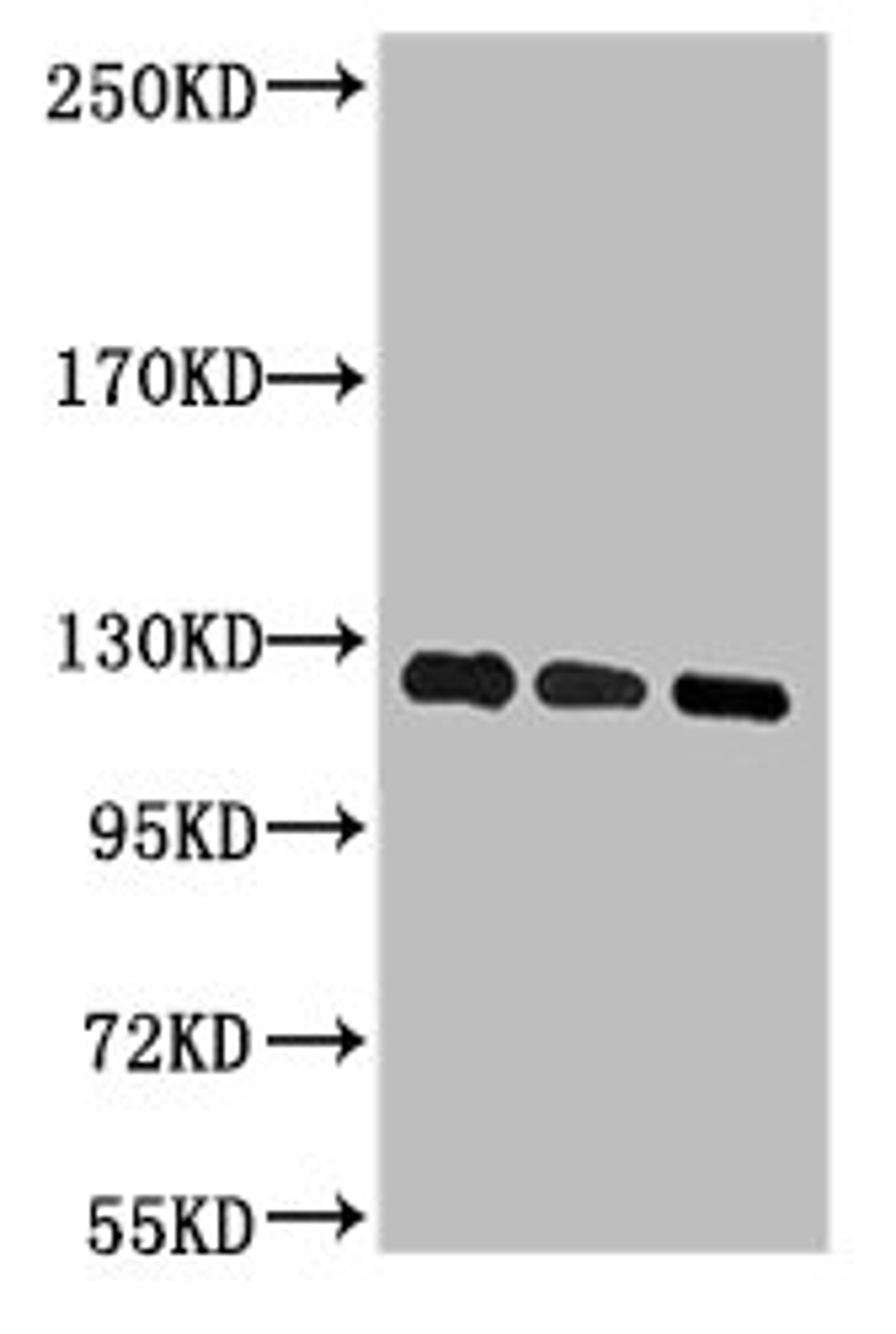 Western blot analysis of 1) Hela, 2) 293T, 3) Jurkat, diluted at 1:2000.