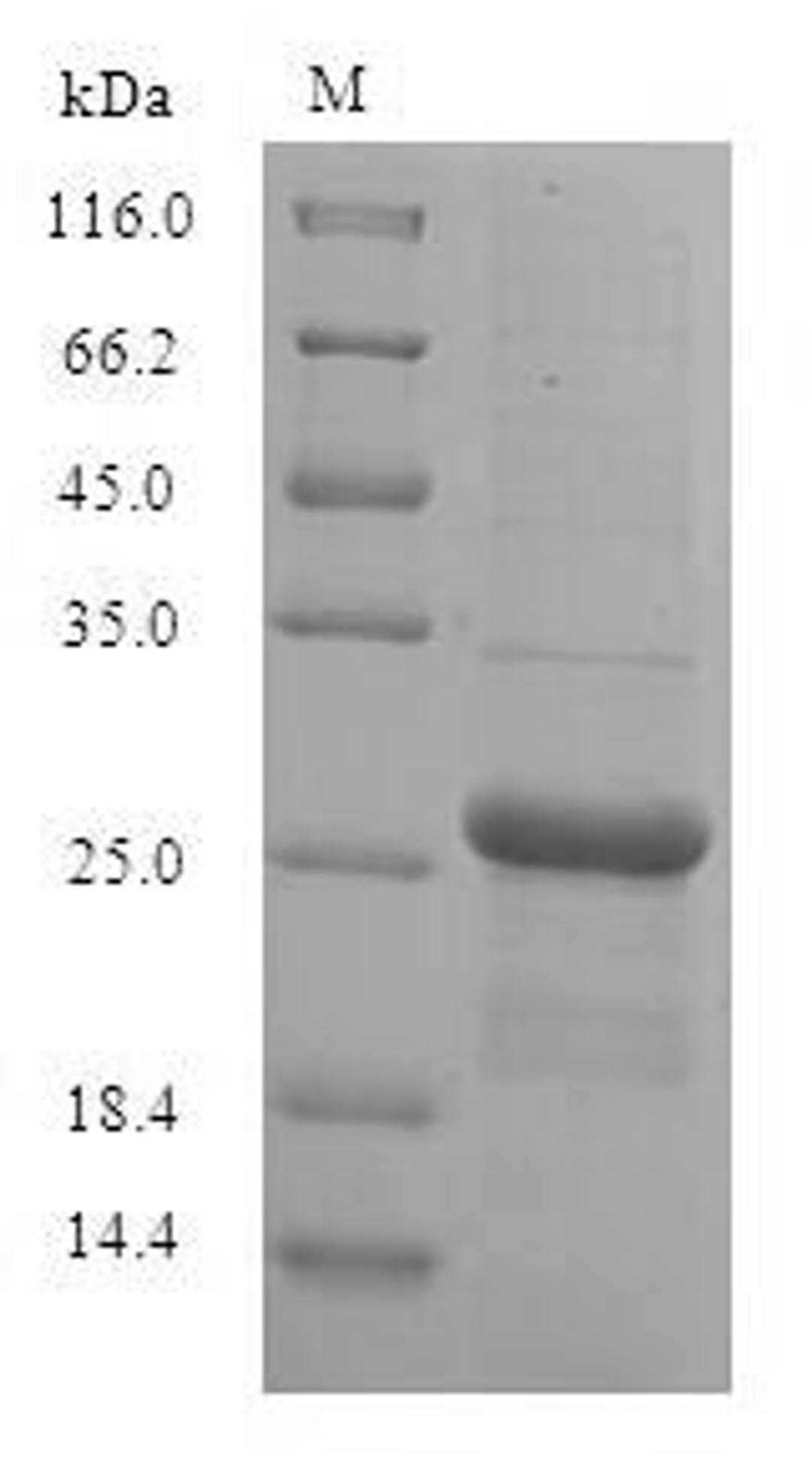 (Tris-Glycine gel) Discontinuous SDS-PAGE (reduced) with 5% enrichment gel and 15% separation gel.
