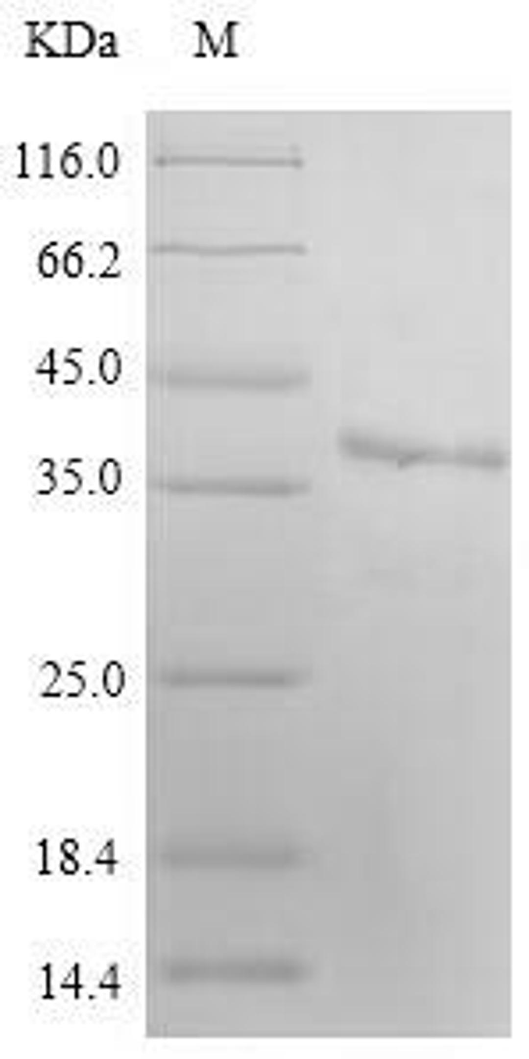(Tris-Glycine gel) Discontinuous SDS-PAGE (reduced) with 5% enrichment gel and 15% separation gel.