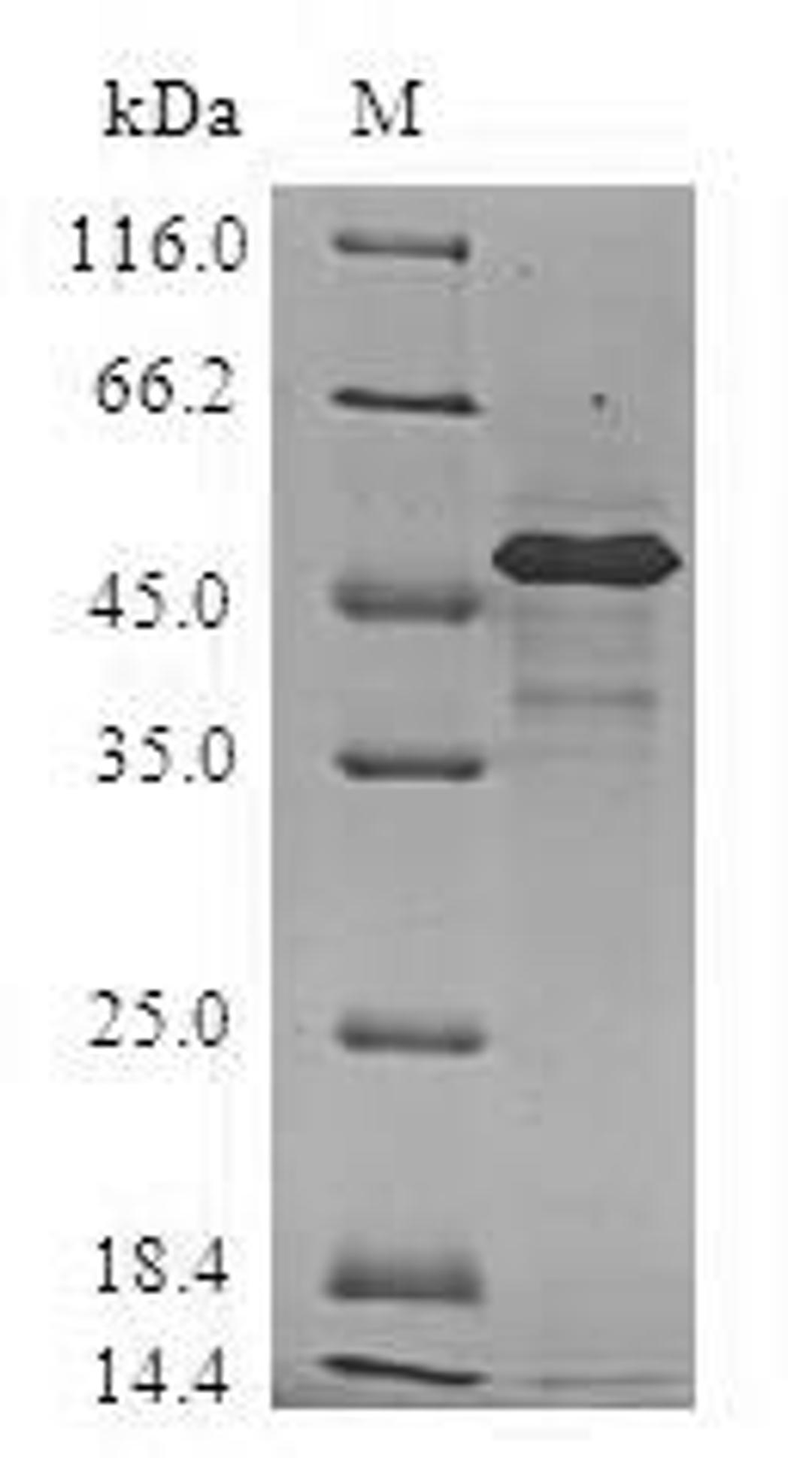 (Tris-Glycine gel) Discontinuous SDS-PAGE (reduced) with 5% enrichment gel and 15% separation gel.