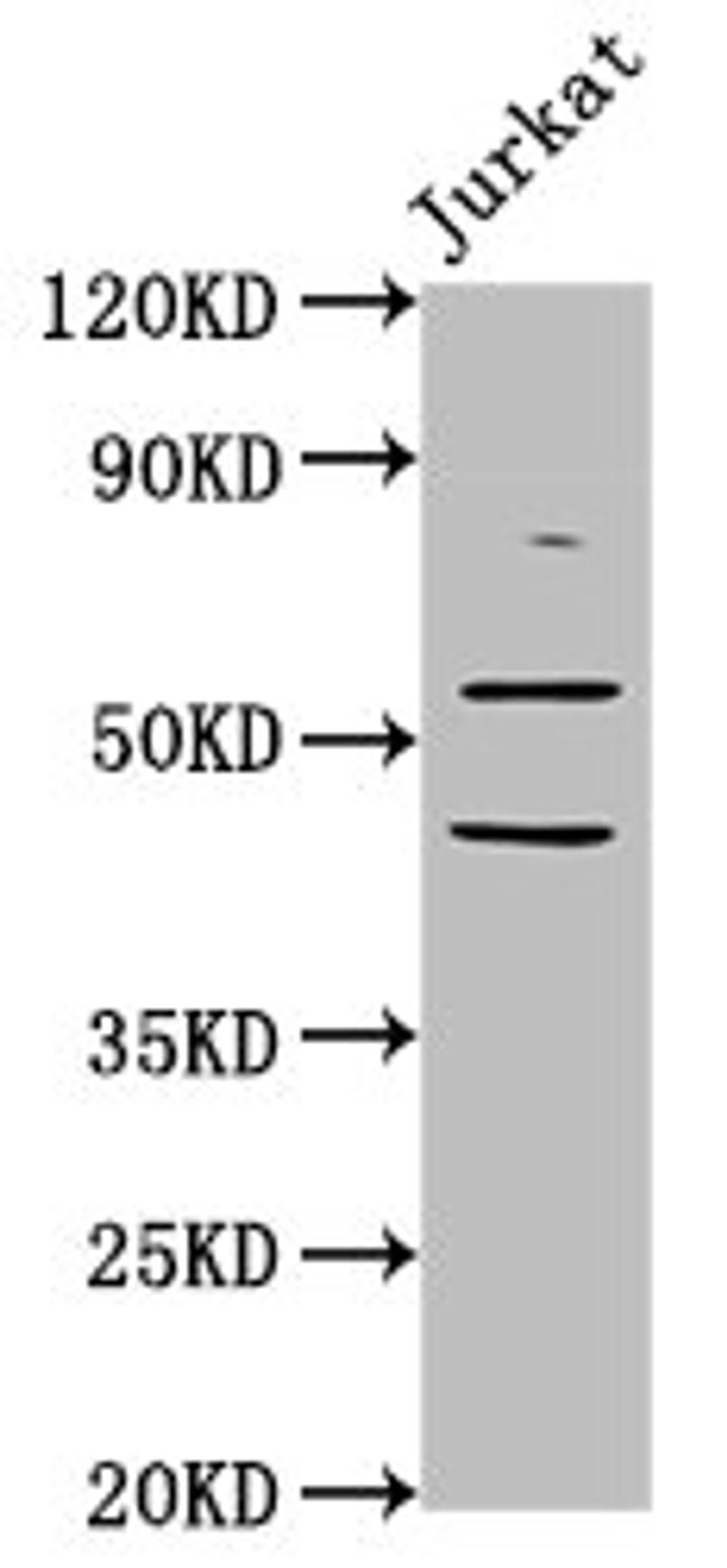 Western Blot. Positive WB detected in: Jurkat whole cell lysate. All lanes: CHRNB2 antibody at 6.05ug/ml. Secondary. Goat polyclonal to rabbit IgG at 1/50000 dilution. Predicted band size: 58 kDa. Observed band size: 58 kDa.