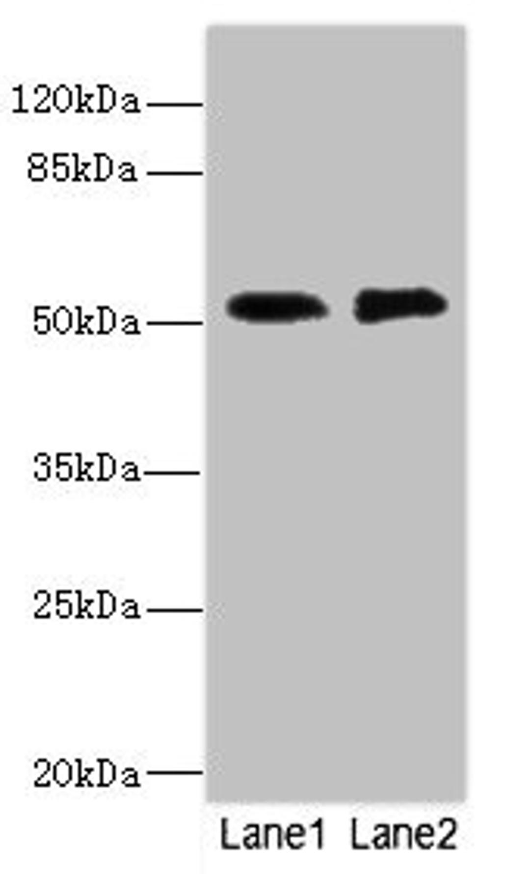 Western blot. All lanes: TMOD1 antibody at 2.84ug/ml. Lane 1: PC-3 whole cell lysate. Lane 2: 293T whole cell lysate. Secondary. Goat polyclonal to rabbit IgG at 1/10000 dilution. Predicted band size: 53, 24 kDa. Observed band size: 53 kDa. 