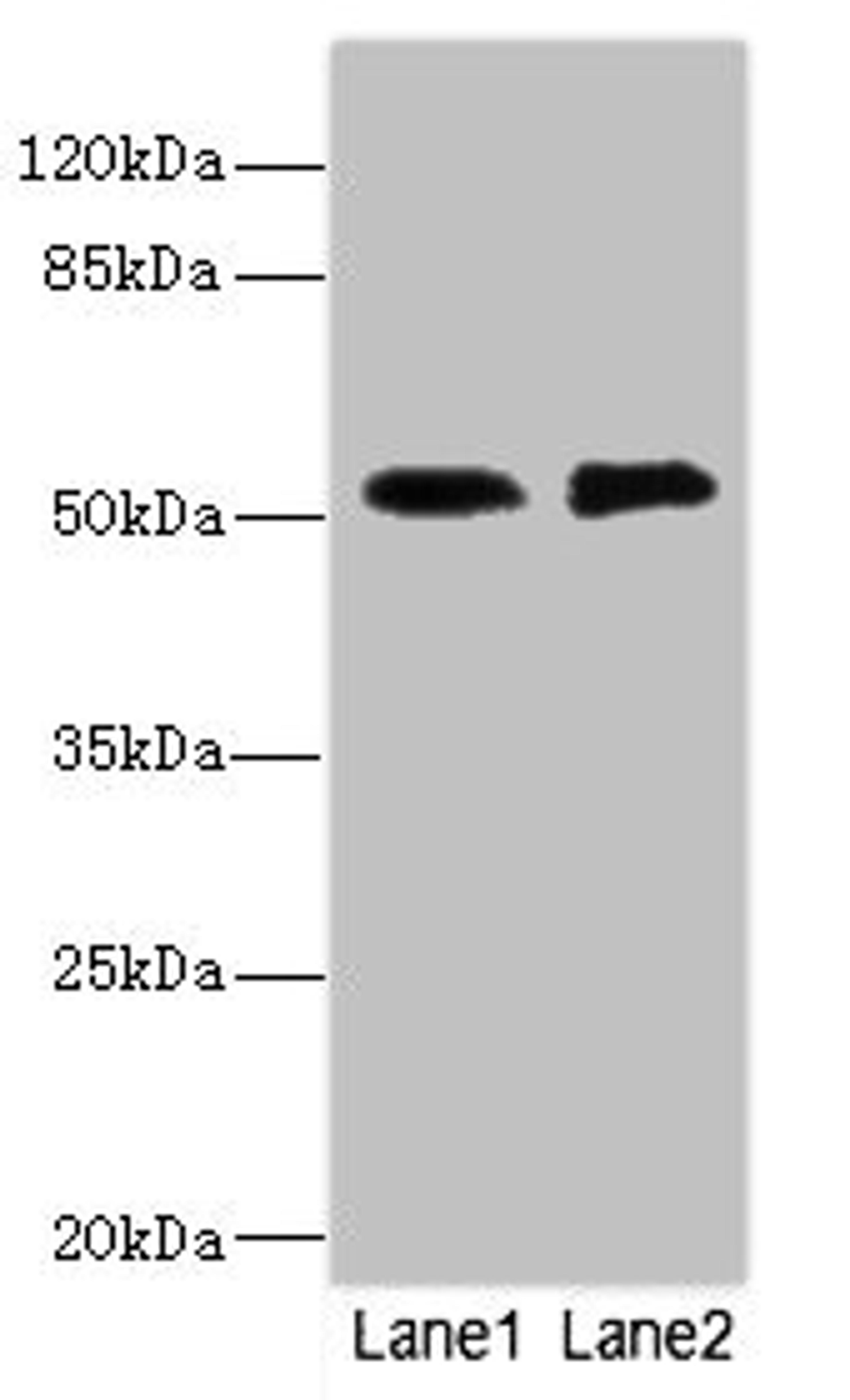 Western blot. All lanes: TMOD1 antibody at 2.84ug/ml. Lane 1: PC-3 whole cell lysate. Lane 2: 293T whole cell lysate. Secondary. Goat polyclonal to rabbit IgG at 1/10000 dilution. Predicted band size: 53, 24 kDa. Observed band size: 53 kDa. 
