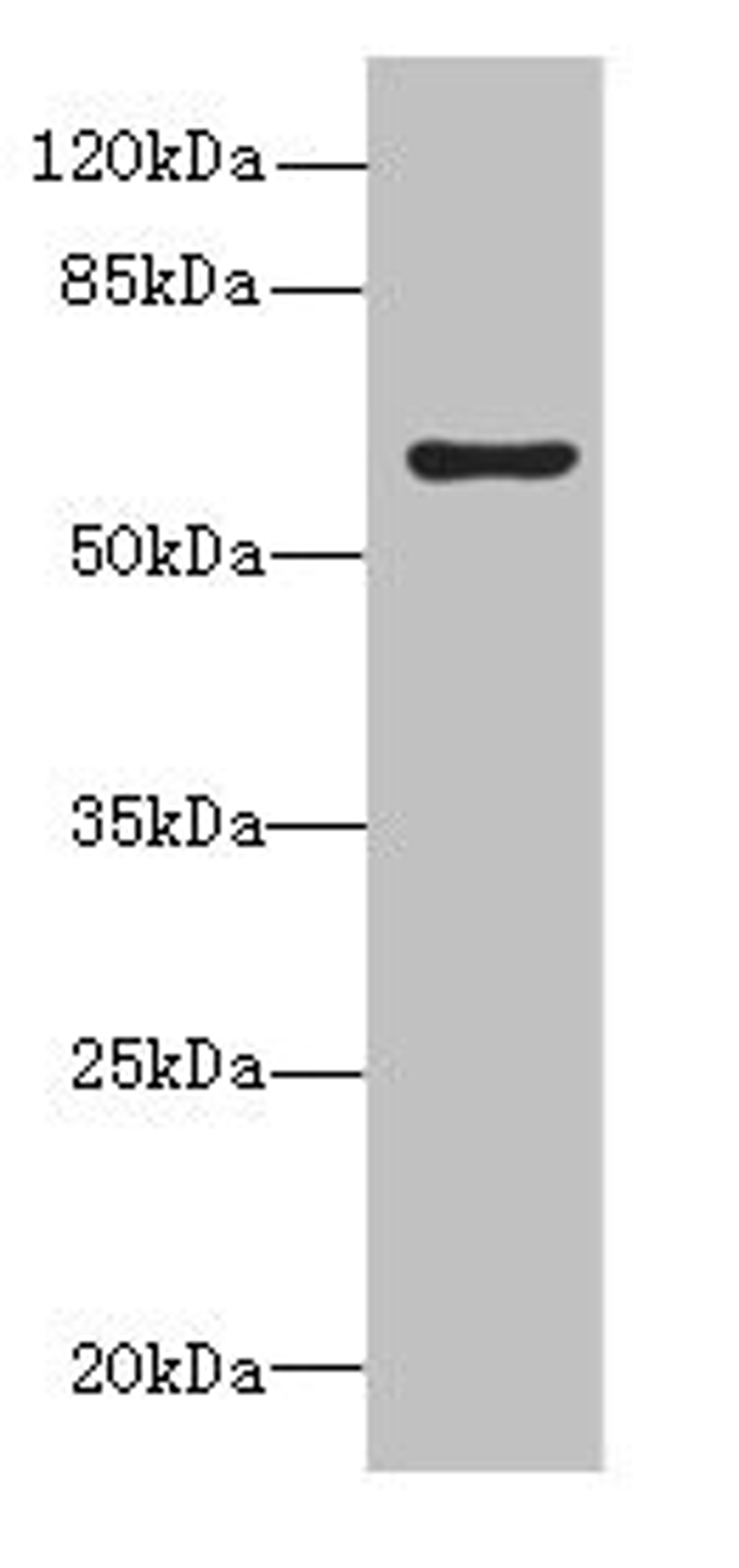 Western blot. All lanes: KHDC4 antibody at 5µg/ml + Mouse liver tissue. Secondary. Goat polyclonal to rabbit IgG at 1/10000 dilution. Predicted band size: 65, 60, 41, 25 kDa. Observed band size: 65 kDa