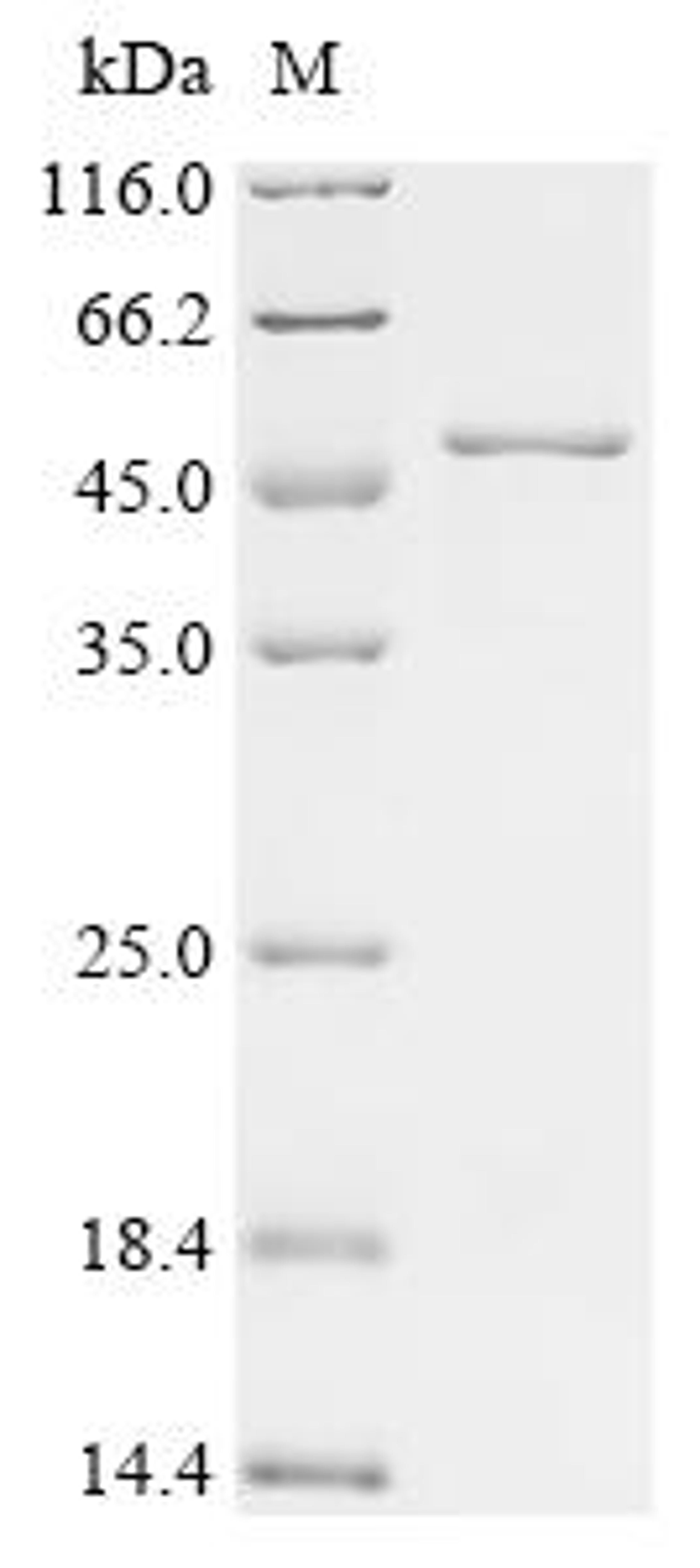 (Tris-Glycine gel) Discontinuous SDS-PAGE (reduced) with 5% enrichment gel and 15% separation gel.
