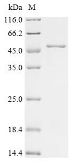 (Tris-Glycine gel) Discontinuous SDS-PAGE (reduced) with 5% enrichment gel and 15% separation gel.