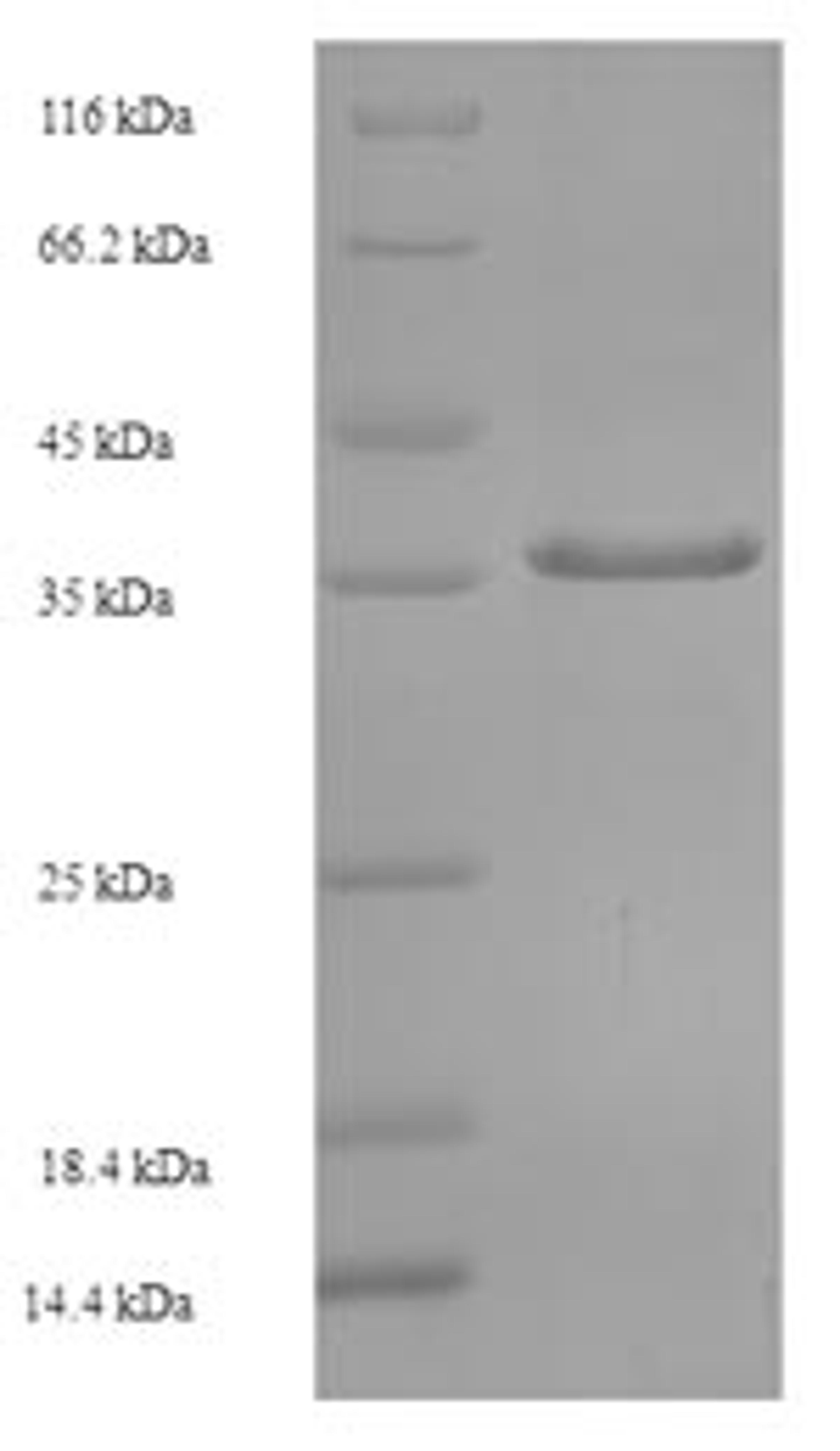 (Tris-Glycine gel) Discontinuous SDS-PAGE (reduced) with 5% enrichment gel and 15% separation gel.