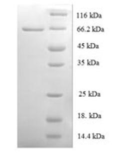 (Tris-Glycine gel) Discontinuous SDS-PAGE (reduced) with 5% enrichment gel and 15% separation gel.