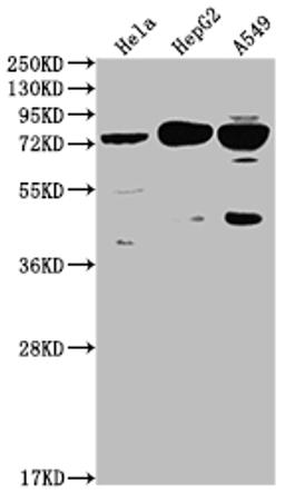 Western Blot. Positive WB detected in: Hela whole cell lysate, HepG2 whole cell lysate, A549 whole cell lysate. All lanes: HTR2C antibody at 1:2000. Secondary. Goat polyclonal to rabbit IgG at 1/50000 dilution. Predicted band size: 52, 29 kDa. Observed band size: 75 kDa. 