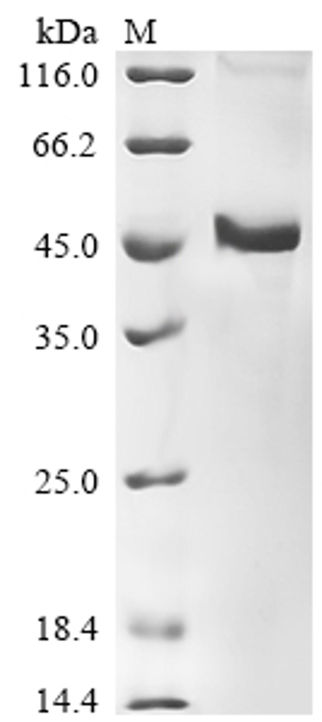 (Tris-Glycine gel) Discontinuous SDS-PAGE (reduced) with 5% enrichment gel and 15% separation gel.