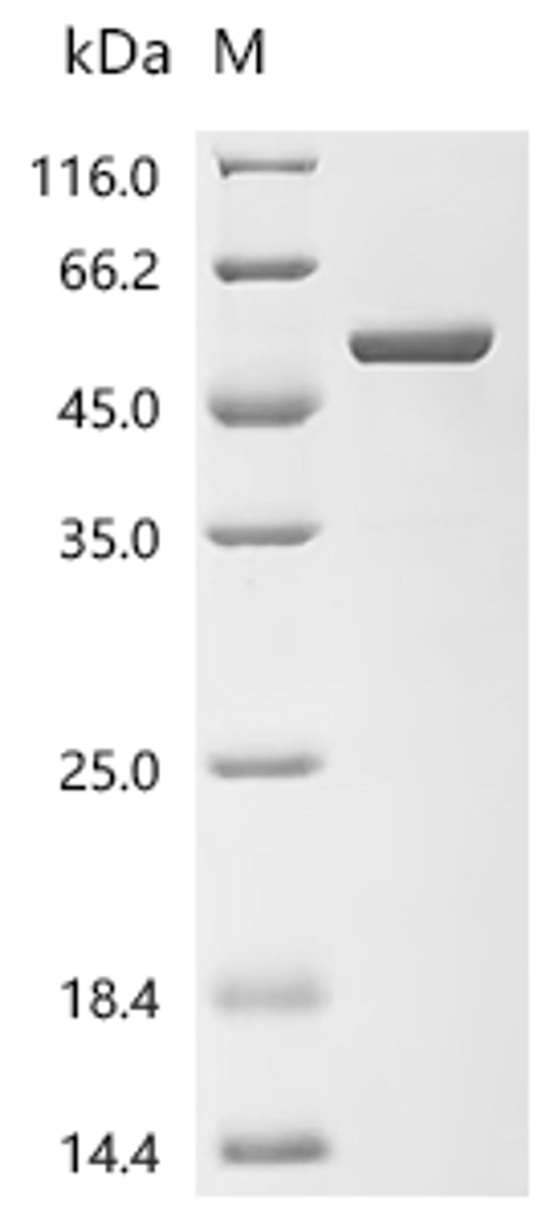 (Tris-Glycine gel) Discontinuous SDS-PAGE (reduced) with 5% enrichment gel and 15% separation gel.
