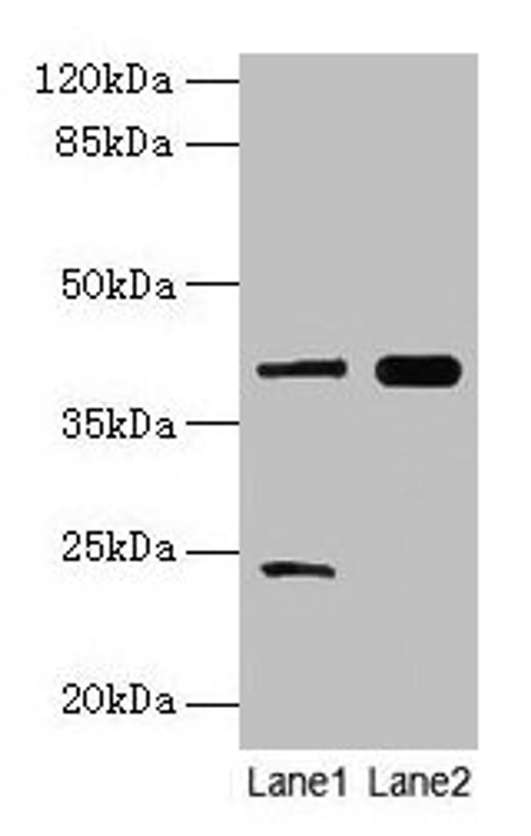 Western blot. All lanes: MAP2K3 antibody at 10µg/ml. Lane 1: RAW264.7 whole cell lysate. Lane 2: Mouse skeletal muscle tissue. Secondary. Goat polyclonal to rabbit IgG at 1/10000 dilution. Predicted band size: 40, 37 kDa. Observed band size: 40 kDa
