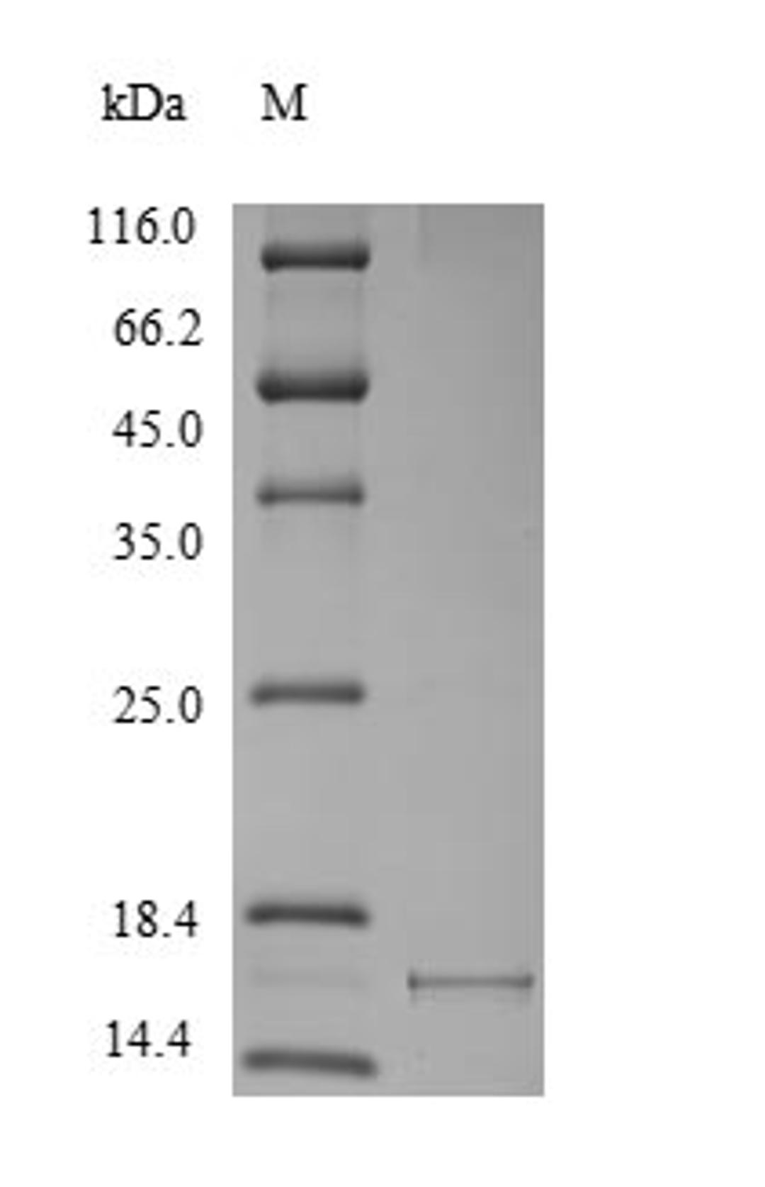 (Tris-Glycine gel) Discontinuous SDS-PAGE (reduced) with 5% enrichment gel and 15% separation gel.