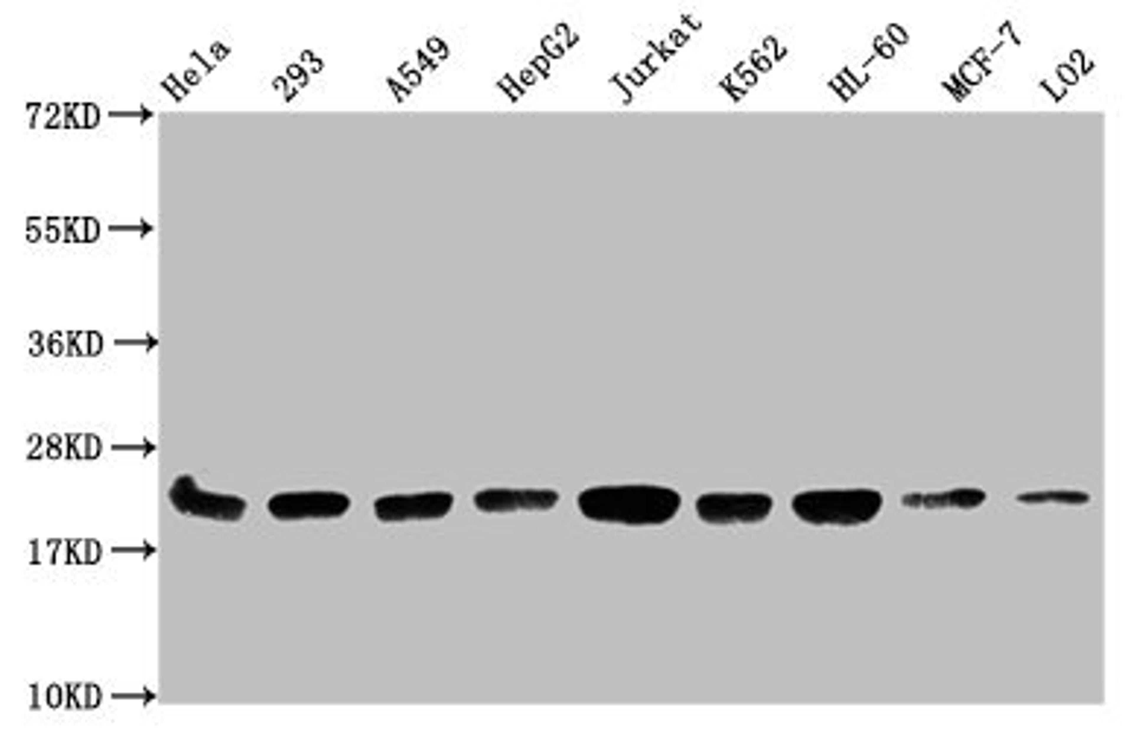 Western Blot. Positive WB detected in: Hela whole cell lysate, 293 whole cell lysate, A549 whole cell lysate, HepG2 whole cell lysate, Jurkat whole cell lysate, K562 whole cell lysate, HL60 whole cell lysate, MCF-7 whole cell lysate, LO2 whole cell lysate. All lanes: HIST1H1C antibody at 1:500. Secondary. Goat polyclonal to rabbit IgG at 1/40000 dilution. Predicted band size: 22 kDa. Observed band size: 22 kDa