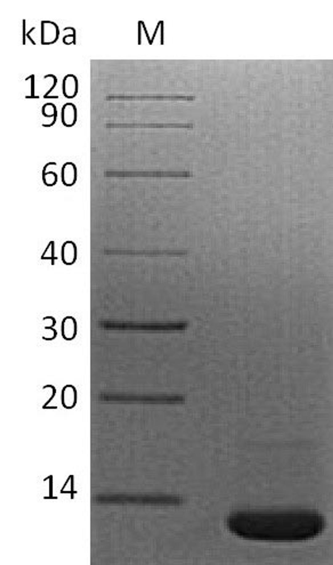 (Tris-Glycine gel) Discontinuous SDS-PAGE (reduced) with 5% enrichment gel and 15% separation gel.