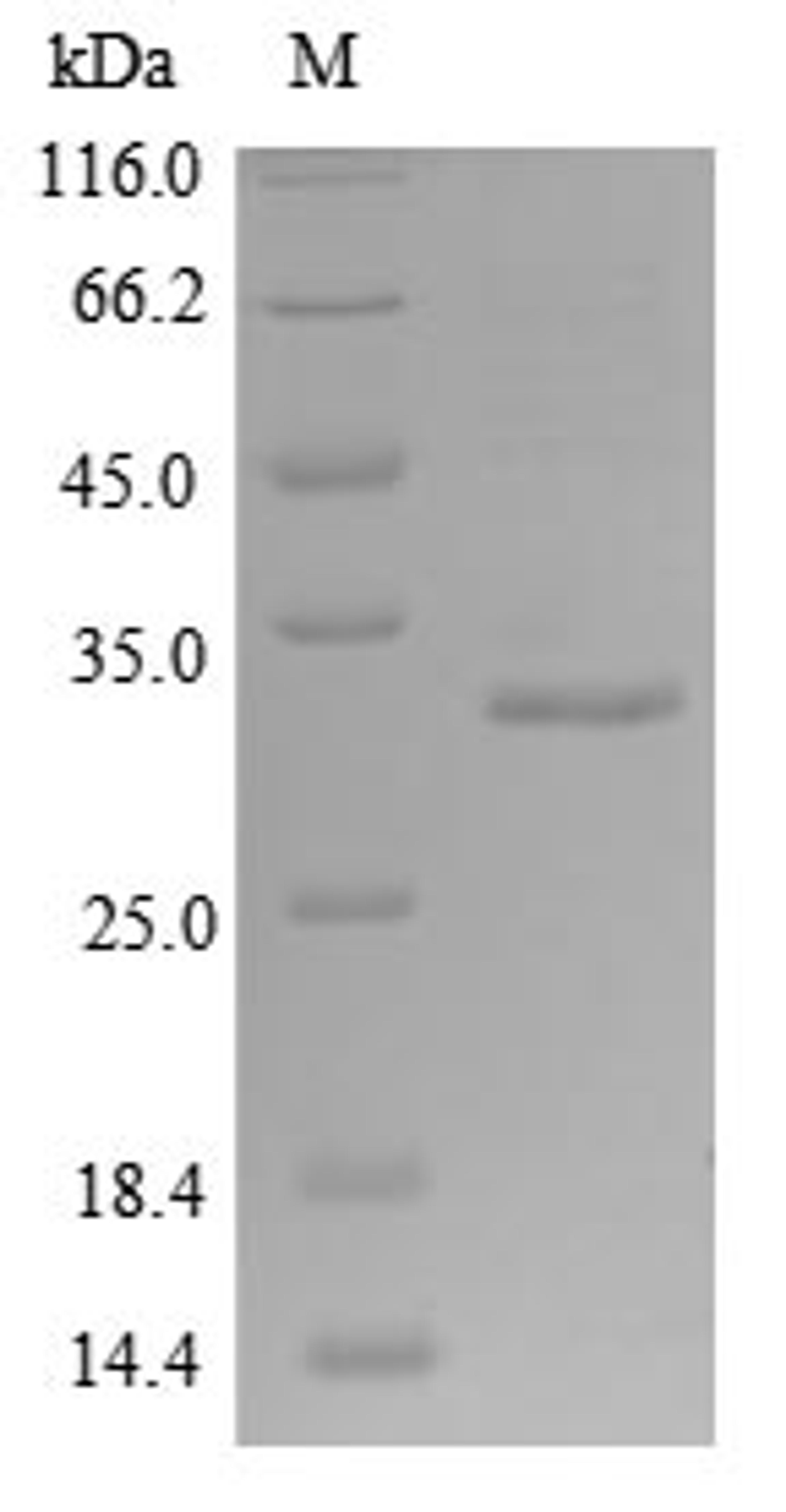 (Tris-Glycine gel) Discontinuous SDS-PAGE (reduced) with 5% enrichment gel and 15% separation gel.