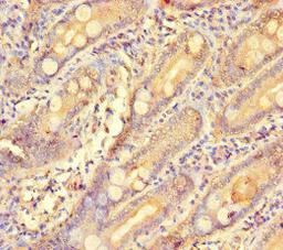 Immunohistochemistry of paraffin-embedded human small intestine tissue using CSB-PA009318LA01HU at dilution of 1:100