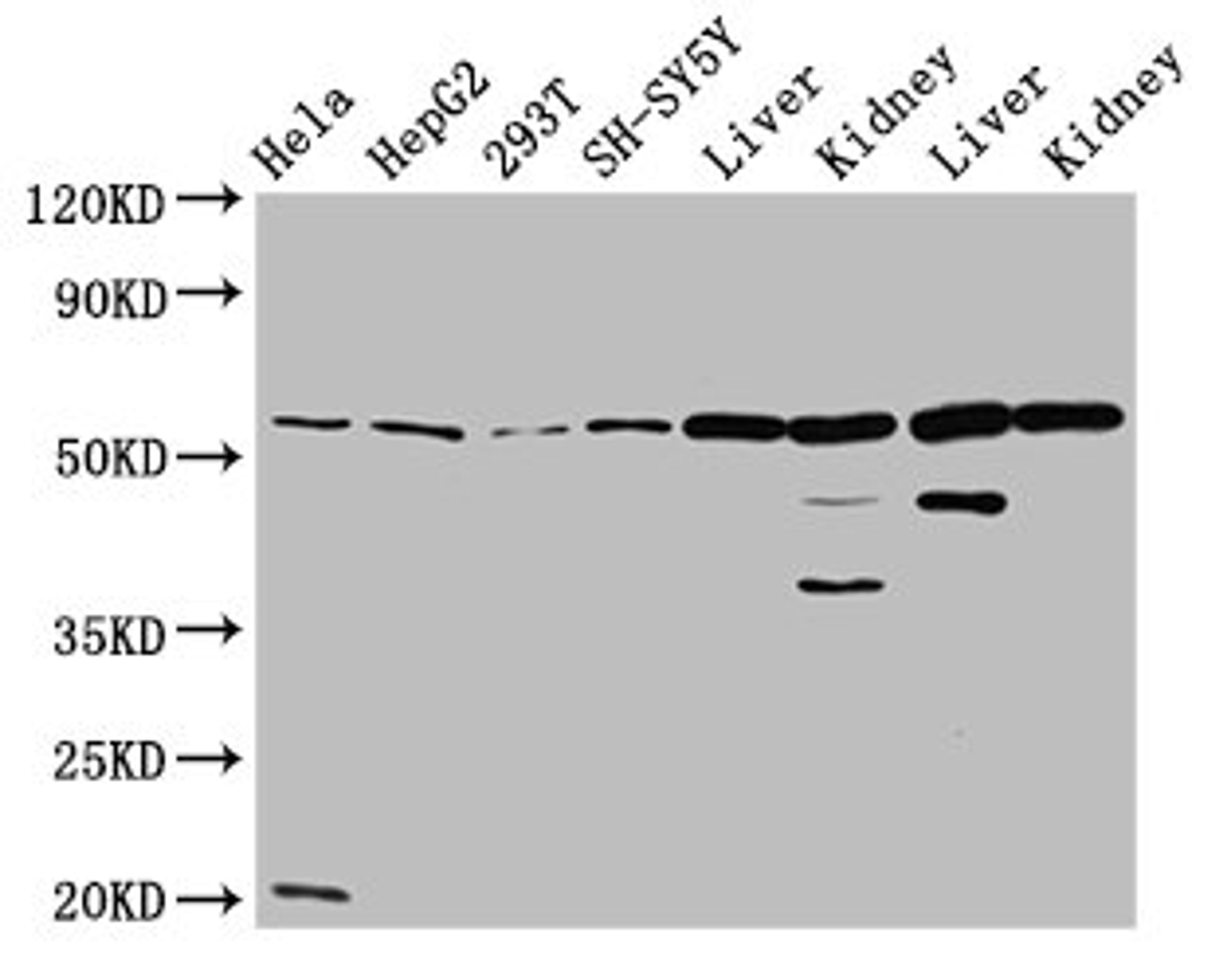 Western Blot. Positive WB detected in: Hela whole cell lysate, HepG2 whole cell lysate, 293T whole cell lysate, SH-SY5Y whole cell lysate, Rat liver tissue, Rat kidney tissue, Mouse liver tissue, Mouse kidney tissue. All lanes: ALDH7A1 antibody at 4.7µg/ml. Secondary. Goat polyclonal to rabbit IgG at 1/50000 dilution. Predicted band size: 59, 56, 52 kDa. Observed band size: 59 kDa