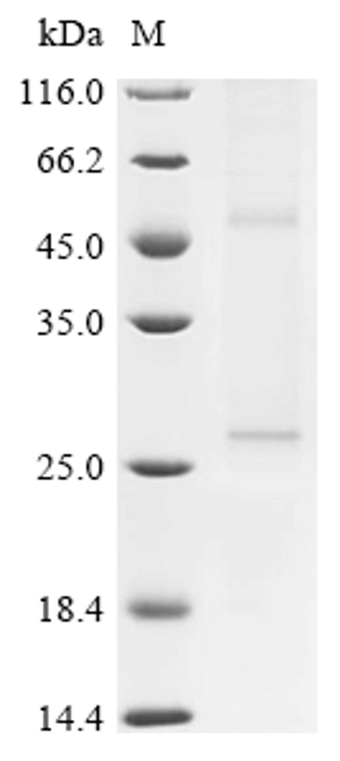 (Tris-Glycine gel) Discontinuous SDS-PAGE (reduced) with 5% enrichment gel and 15% separation gel.