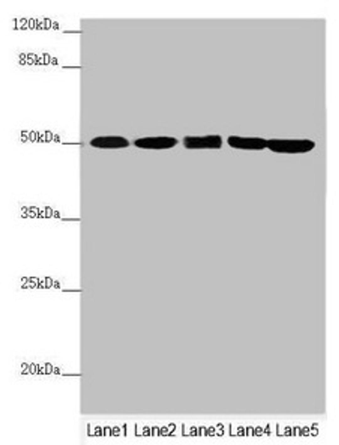 Western blot. All lanes: EEF1G antibody at 0.78µg/ml. Lane 1: Mouse gonadal tissue. Lane 2: PC-3 whole cell lysate. Lane 3: HepG2 whole cell lysate. Lane 4: Hela whole cell lysate. Lane 5: 293T whole cell lysate. Secondary. Goat polyclonal to rabbit IgG at 1/10000 dilution. Predicted band size: 51, 57 kDa. Observed band size: 51 kDa
