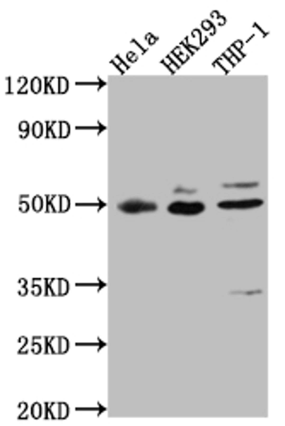 Western Blot. Positive WB detected in: Hela whole cell lysate, HEK293 whole cell lysate, THP-1 whole cell lysate. All lanes: MAPKAPK2 antibody at 1:1000. Secondary. Goat polyclonal to rabbit IgG at 1/50000 dilution. Predicted band size: 46, 43 kDa. Observed band size: 49 kDa. 