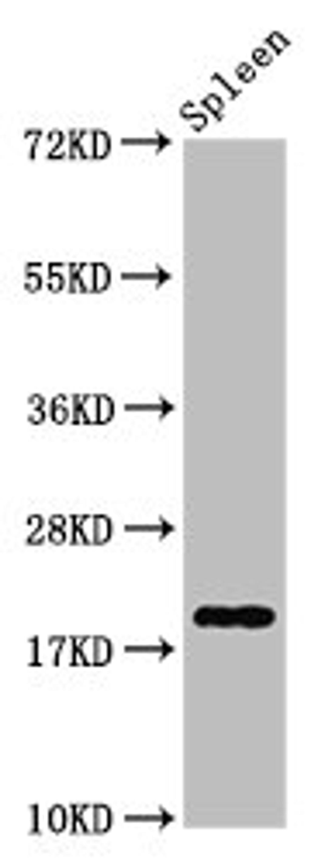 Western Blot. Positive WB detected in: Rat spleen tissue. All lanes: H1F0 antibody at 0.85µg/ml. Secondary. Goat polyclonal to rabbit IgG at 1/50000 dilution. Predicted band size: 21, 20 kDa. Observed band size: 21 kDa