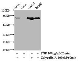 Western Blot. Positive WB detected in Hela whole cell lysate,HepG2 whole cell lysate(treated with Calyculin A or EGF). All lanes Phospho-GYS1 antibody at 1.12μg/ml. Secondary. Goat polyclonal to rabbit IgG at 1/50000 dilution. Predicted band size: 85 KDa. Observed band size: 85 KDa. 
