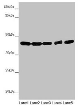 Western blot. All lanes: EIF3M antibody at 2.02µg/ml. Lane 1: Hela whole cell lysate. Lane 2: A549 whole cell lysate. Lane 3: Mouse gonadal tissue. Lane 4: Human placenta tissue. Lane 5: Mouse brain tissue. Secondary. Goat polyclonal to rabbit IgG at 1/10000 dilution. Predicted band size: 43, 28 kDa. Observed band size: 43 kDa
