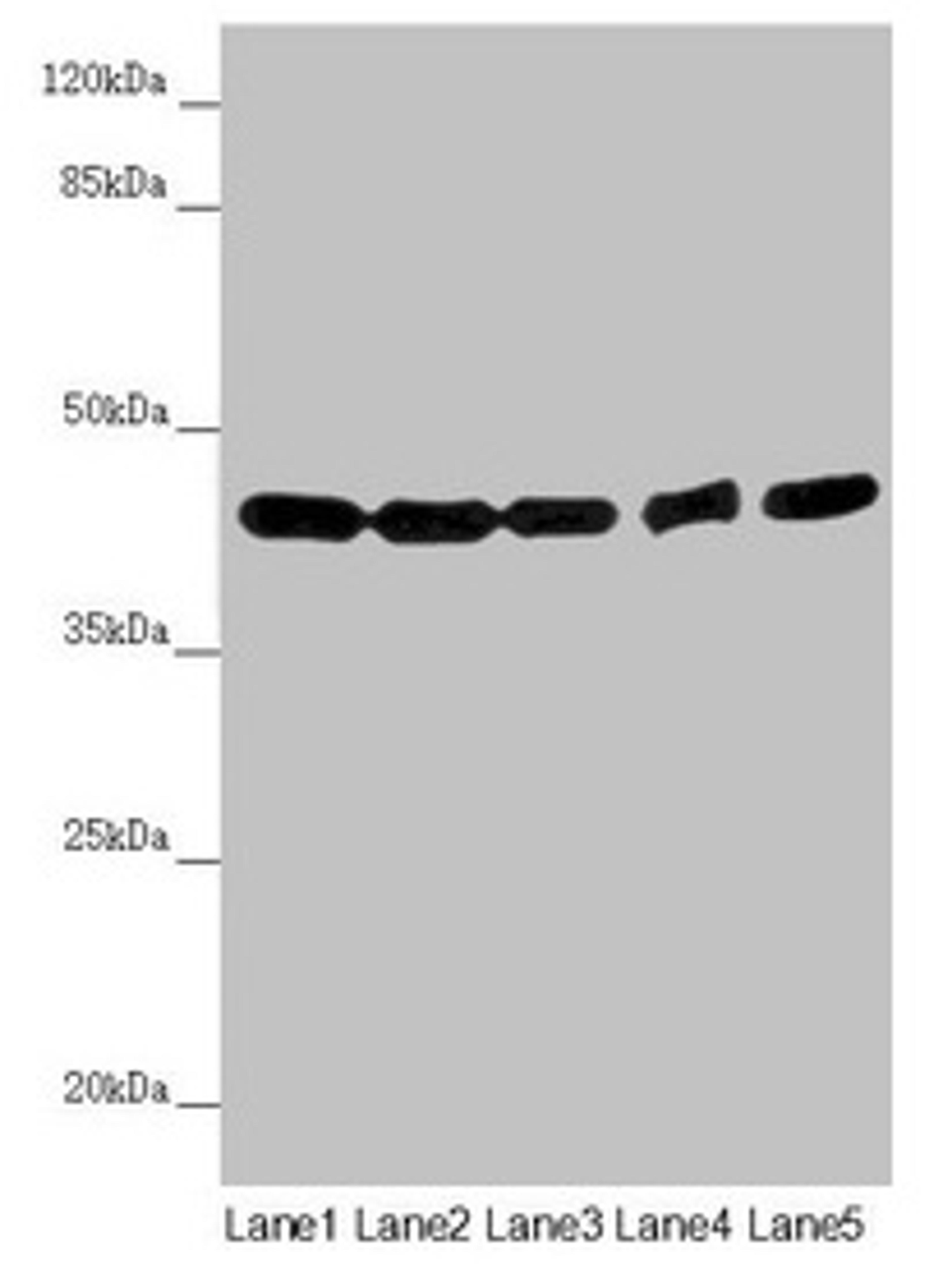 Western blot. All lanes: EIF3M antibody at 2.02µg/ml. Lane 1: Hela whole cell lysate. Lane 2: A549 whole cell lysate. Lane 3: Mouse gonadal tissue. Lane 4: Human placenta tissue. Lane 5: Mouse brain tissue. Secondary. Goat polyclonal to rabbit IgG at 1/10000 dilution. Predicted band size: 43, 28 kDa. Observed band size: 43 kDa