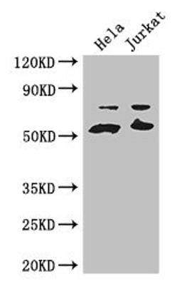 Western Blot. Positive WB detected in: Hela whole cell lysate, Jurkat whole cell lysate. All lanes: YES1 antibody at 3.2ug/ml. Secondary. Goat polyclonal to rabbit IgG at 1/50000 dilution. Predicted band size: 61 kDa. Observed band size: 61, 70 kDa. 