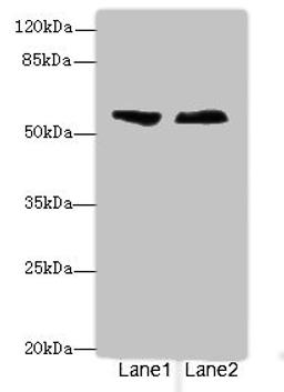 Western blot. All lanes: ENTPD2antibody at 3.6ug/ml. Lane 1: Human placenta tissue. Lane 2: U87 whole cell lysate. Secondary. Goat polyclonal to rabbit IgG at 1/10000 dilution. Predicted band size: 54, 52, 49 kDa. Observed band size: 54 kDa. 