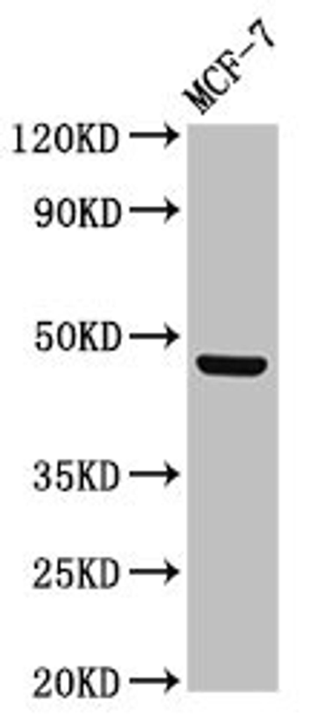 Western Blot. Positive WB detected in: MCF-7 whole cell lysate. All lanes: CERS5 antibody at 3µg/ml. Secondary. Goat polyclonal to rabbit IgG at 1/50000 dilution. Predicted band size: 46, 40 kDa. Observed band size: 46 kDa