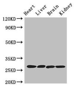 Western Blot. Positive WB detected in: Mouse heart tissue, Mouse liver tissue, Mouse brain tissue, Mouse kidney tissue. All lanes: PRSS2 antibody at 3ug/ml. Secondary. Goat polyclonal to rabbit IgG at 1/50000 dilution. Predicted band size: 27 kDa. Observed band size: 27 kDa. 