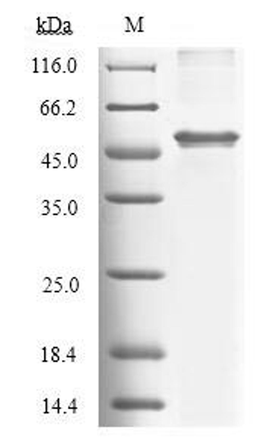 (Tris-Glycine gel) Discontinuous SDS-PAGE (reduced) with 5% enrichment gel and 15% separation gel.