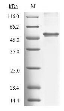 (Tris-Glycine gel) Discontinuous SDS-PAGE (reduced) with 5% enrichment gel and 15% separation gel.