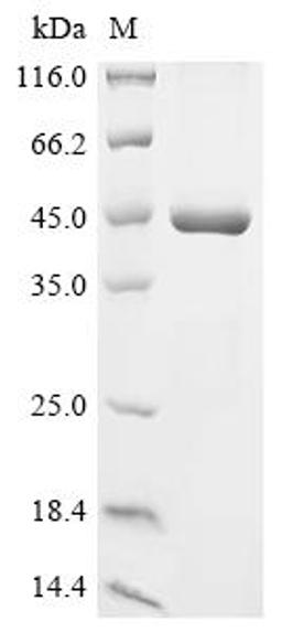 (Tris-Glycine gel) Discontinuous SDS-PAGE (reduced) with 5% enrichment gel and 15% separation gel.