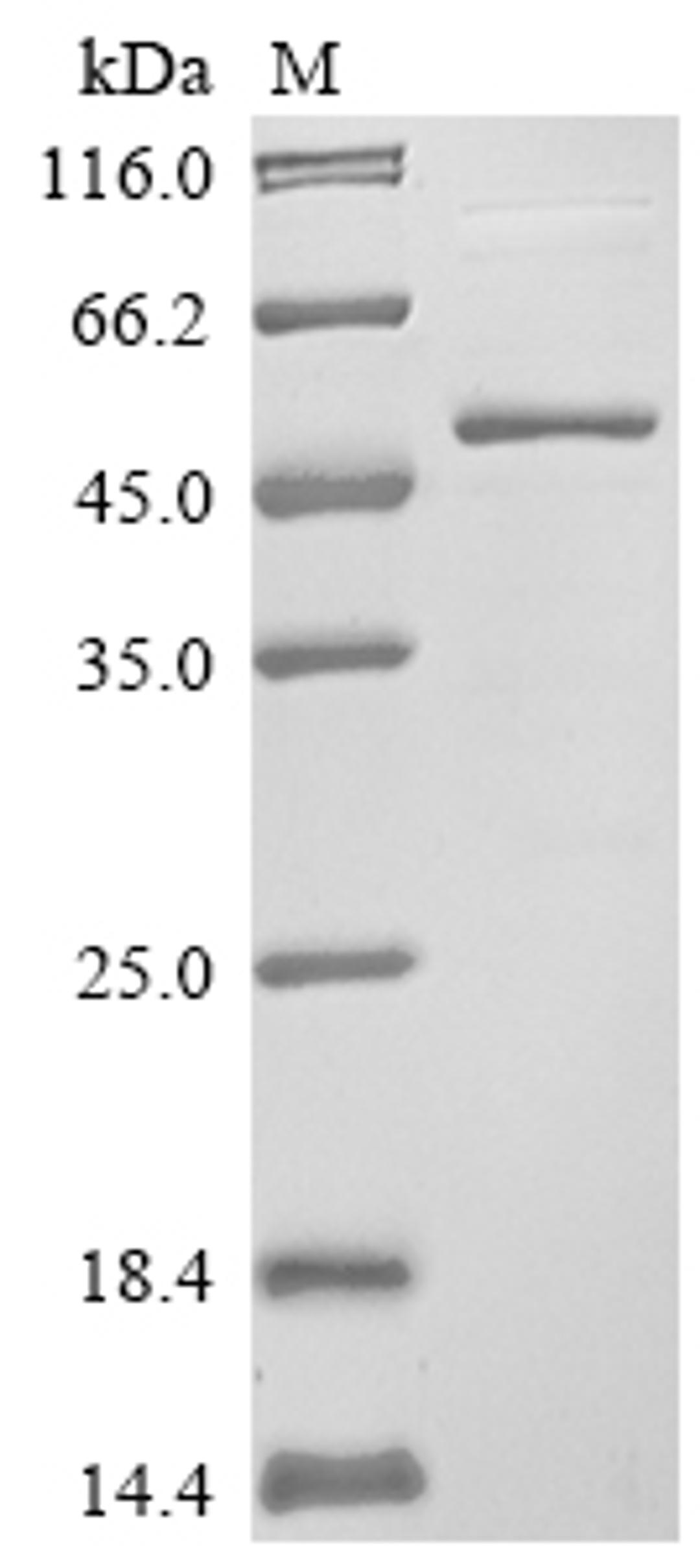 (Tris-Glycine gel) Discontinuous SDS-PAGE (reduced) with 5% enrichment gel and 15% separation gel.