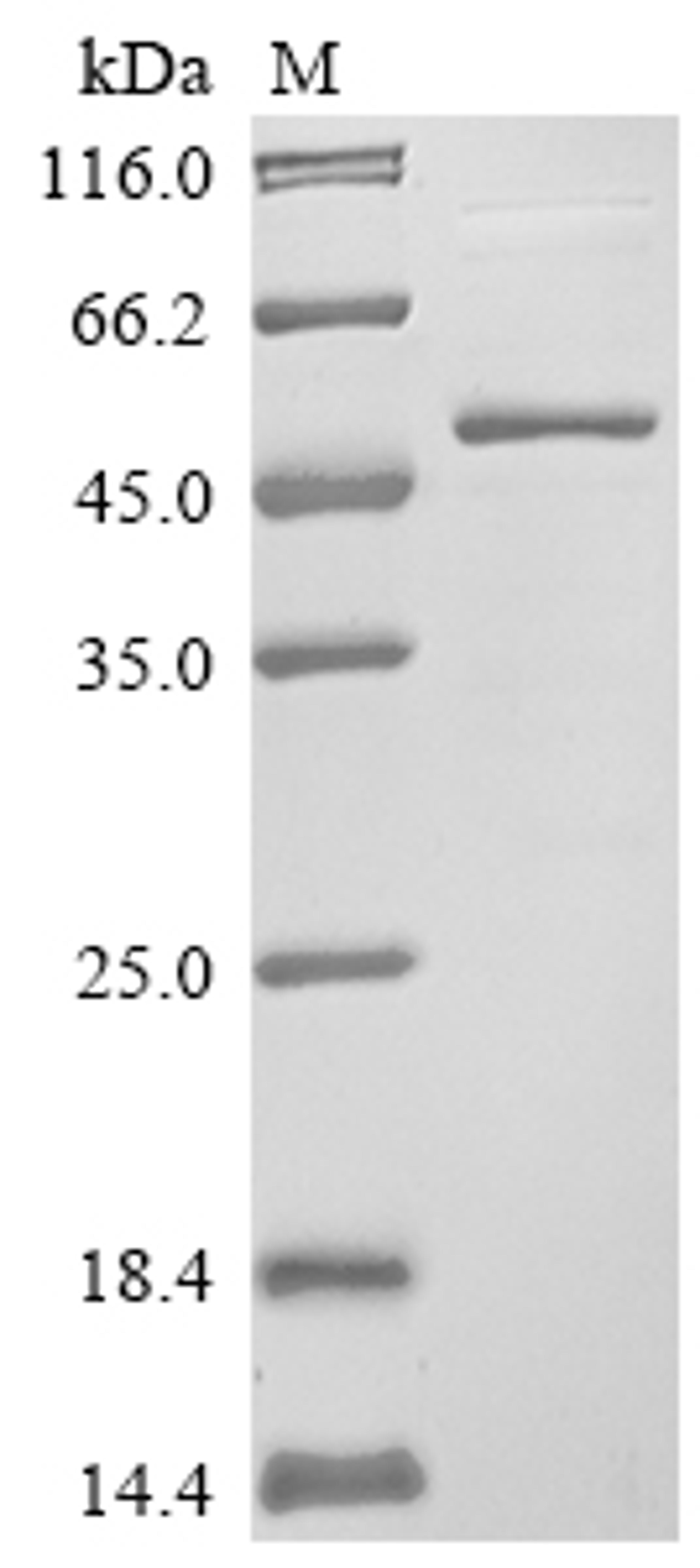 (Tris-Glycine gel) Discontinuous SDS-PAGE (reduced) with 5% enrichment gel and 15% separation gel.