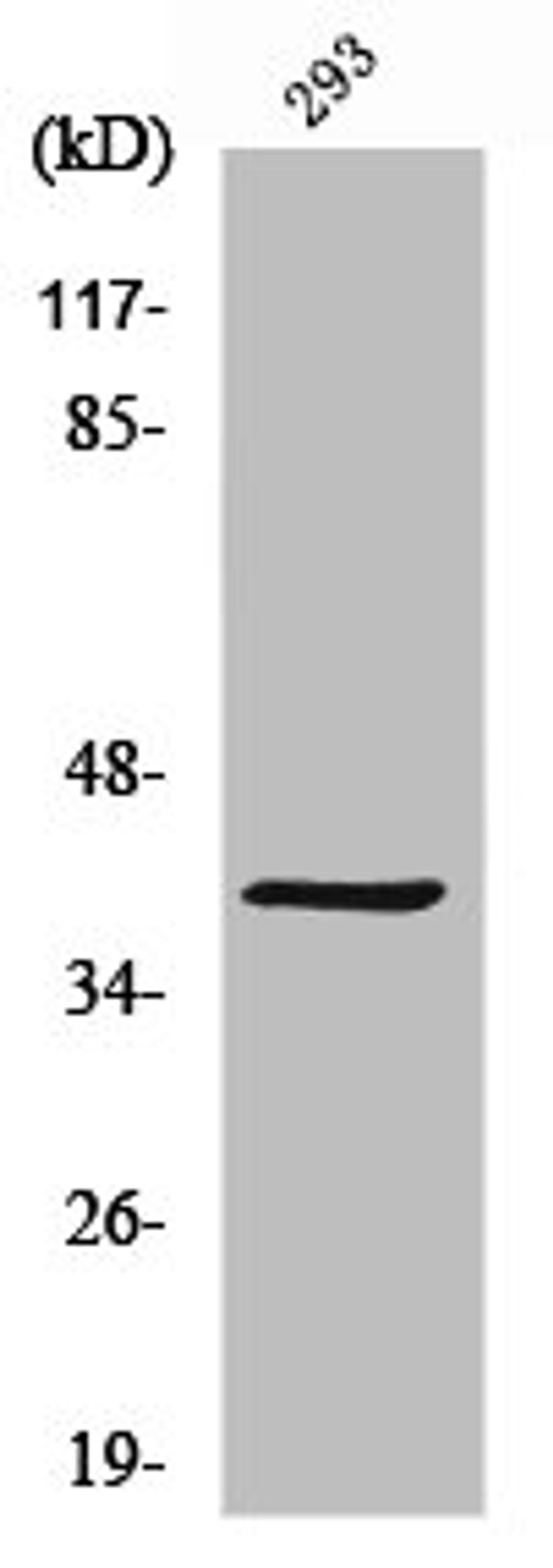 Western Blot analysis of 293 cells using MAGE-C2 Polyclonal Antibody
