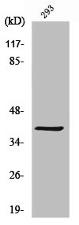 Western Blot analysis of 293 cells using MAGE-C2 Polyclonal Antibody