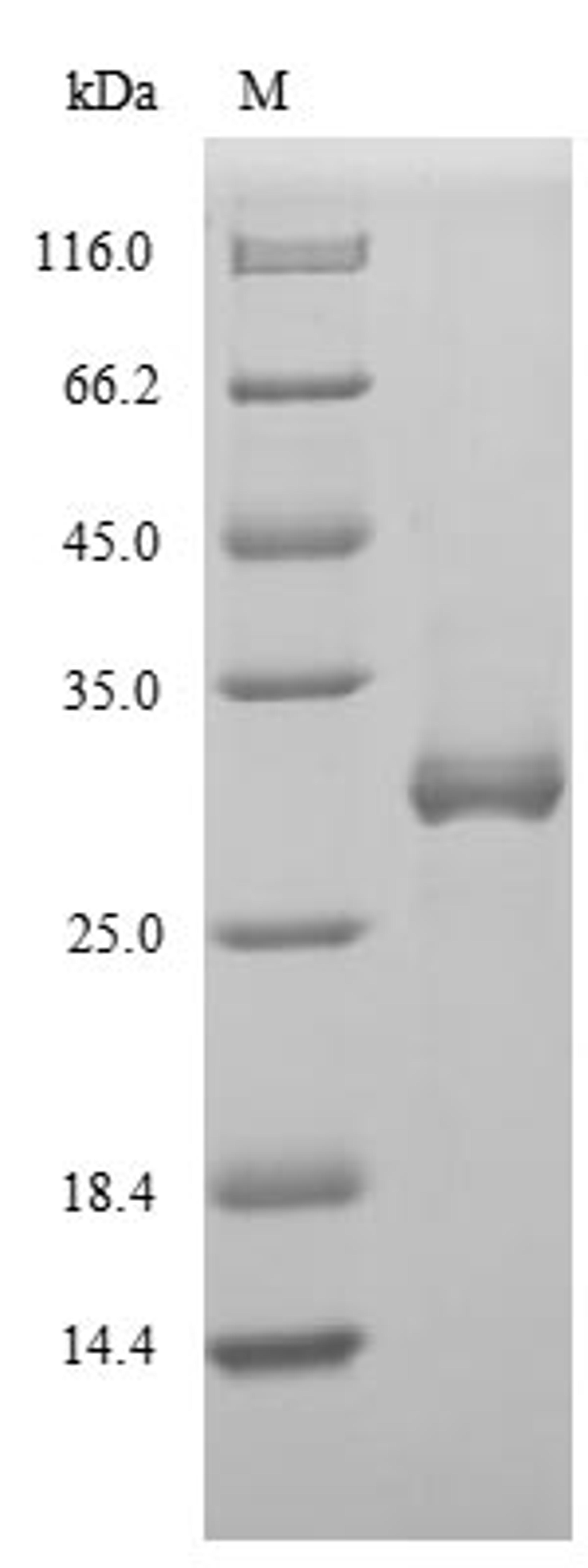 (Tris-Glycine gel) Discontinuous SDS-PAGE (reduced) with 5% enrichment gel and 15% separation gel.