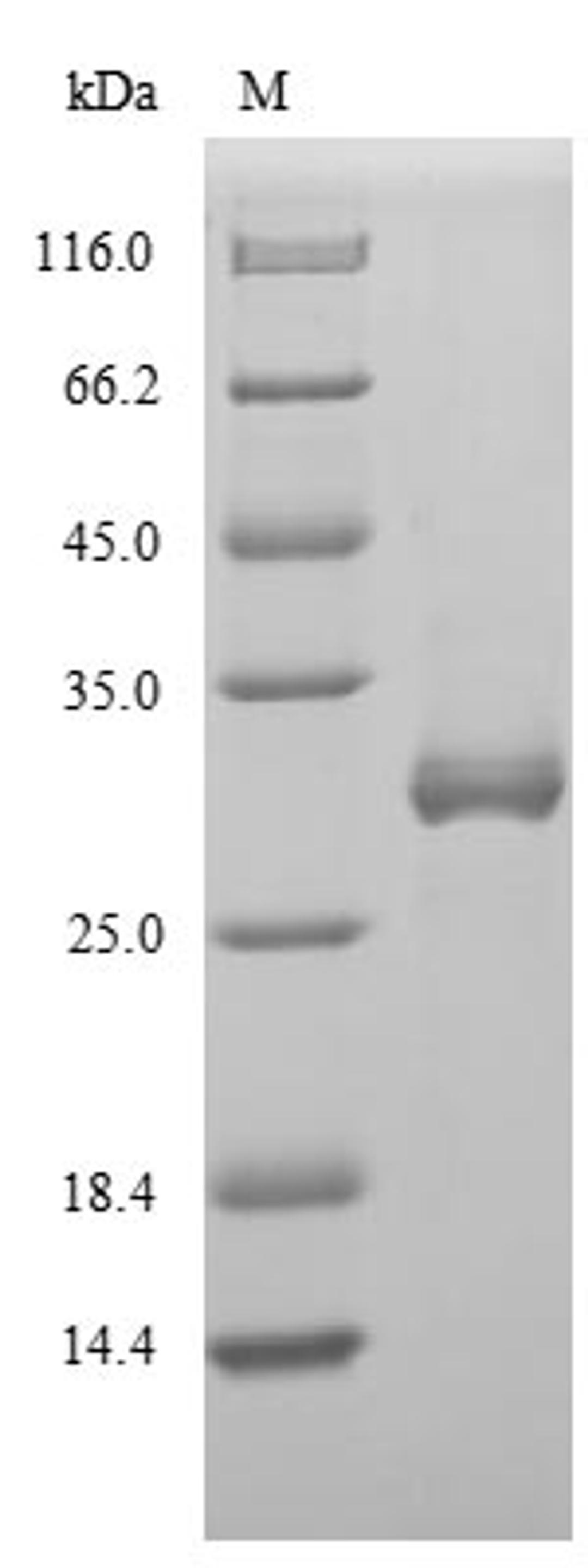 (Tris-Glycine gel) Discontinuous SDS-PAGE (reduced) with 5% enrichment gel and 15% separation gel.