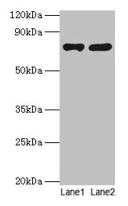 Western blot. All lanes: PARN antibody at 2µg/ml. Lane 1: Jurkat whole cell lysate. Lane 2: A431 whole cell lysate. Secondary. Goat polyclonal to rabbit IgG at 1/10000 dilution. Predicted band size: 74, 67, 68, 53 kDa. Observed band size: 74 kDa