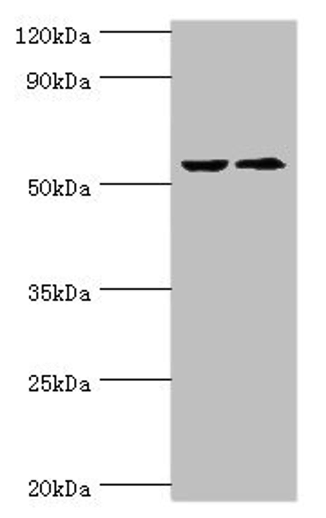 Western blot. All lanes: CASP8 antibody at 2µg/ml. Lane 1: ACCM whole cell lysate. Lane 2: LO2 whole cell lysate. Secondary. Goat polyclonal to rabbit IgG at 1/10000 dilution. Predicted band size: 56, 54, 46, 58, 28, 26, 33, 31, 62 kDa. Observed band size: 56 kDa