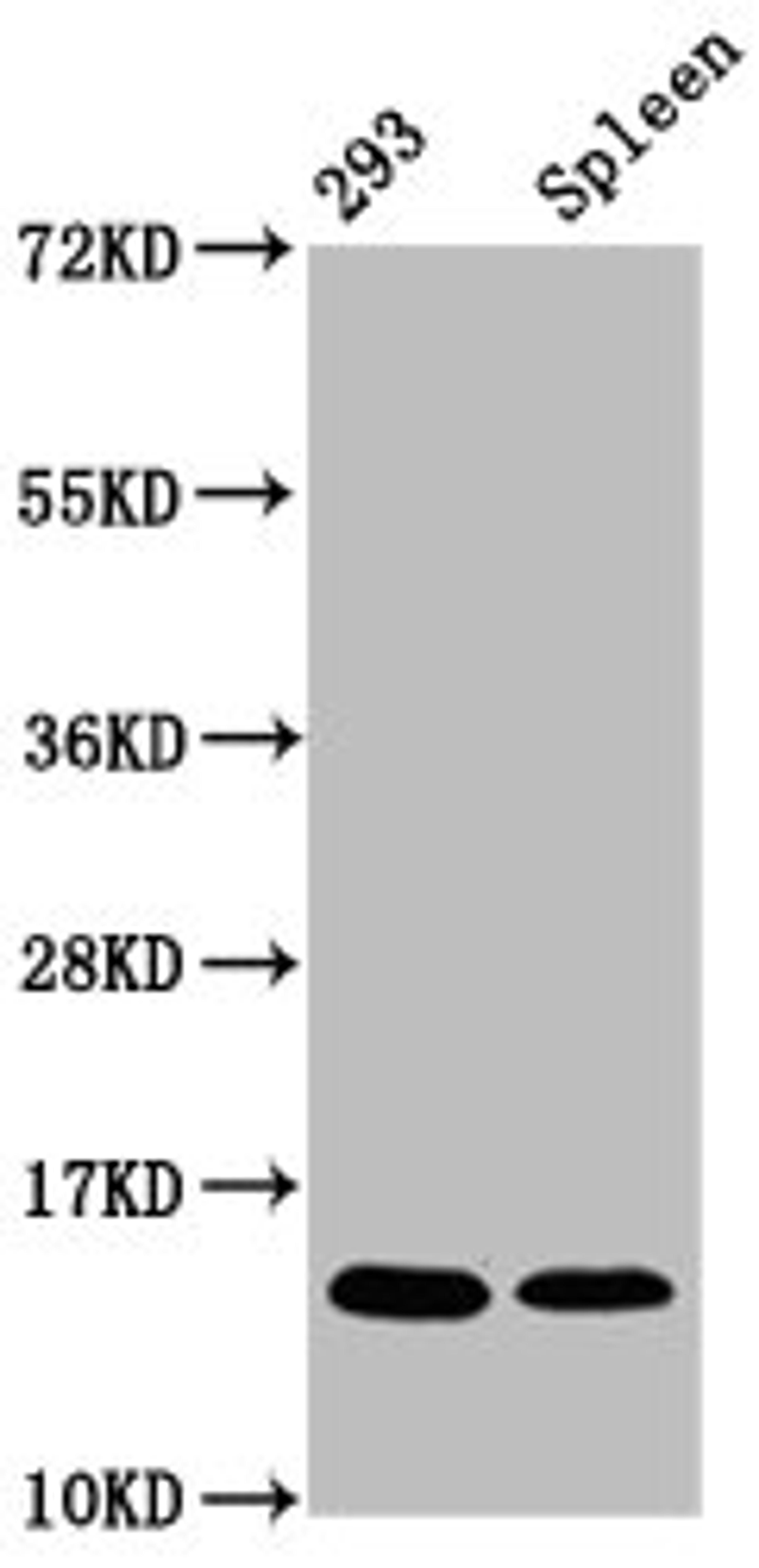 Western Blot. Positive WB detected in: 293 whole cell lysate, Rat spleen tissue. All lanes: HIST1H2BC antibody at 1.64µg/ml. Secondary. Goat polyclonal to rabbit IgG at 1/50000 dilution. Predicted band size: 14 kDa. Observed band size: 14 kDa